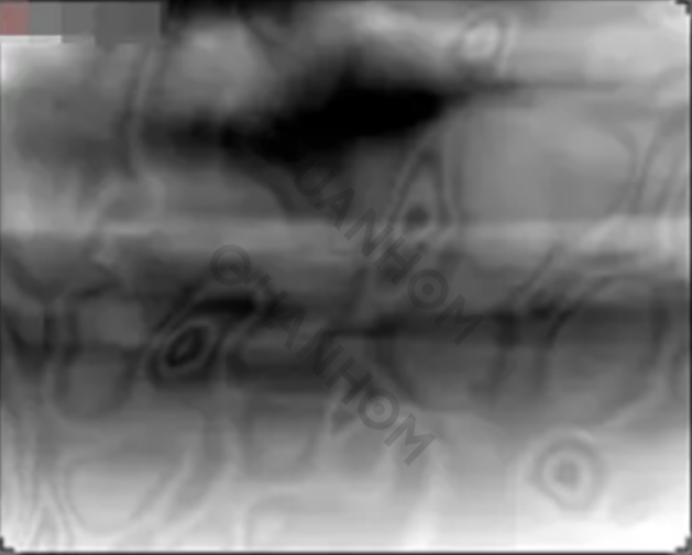 What Are Bad Pixels, Ghost Images And Vignetting effect In Infrared Imaging4.png